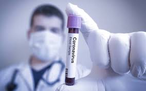 CoronavIrus